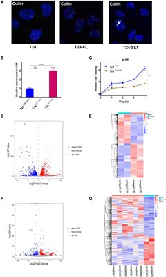 Transcriptomic Analysis of Gene Networks Regulated by U11 Small Nuclear RNA in Bladder Cancer